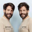 Nioxin System 1 Cleanser & Scalp Therapy Revitaliser - Shampoo 300ml & Conditioner 300ml