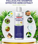 PHARMBANNER Folliculitis & Seborrheic Dermatitis Shampoo  Anti-Dandruff, Psoriasis & Itchy Scalp Treatment  Soothes Redness, Flaking & Irritation  250ml