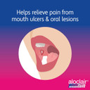 Aloclair Plus Bioadhesive Mouth Ulcer Treatment Mouthwash 120ml. Long lasting protection, up to10-Hour Protection, Soothes Mouth Ulcers & Oral Lesions, for Adults & Children 4 Years +