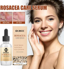 Redness Relief for Face, Rosacea Repair Secrums, Redness Reducing Treat, Moisturizing Facial Serums To Repair Skin Barrier, 1 Fl Oz Bexdug