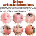 Redness Relief for Face, Rosacea Repair Secrums, Redness Reducing Treat, Moisturizing Facial Serums To Repair Skin Barrier, 1 Fl Oz Bexdug