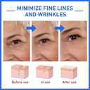 2PCS Boto-x Stock Solution?Boto-x Face Serum UK?Collagen Serum for Face? Boto-x In A Bottle? Boto-x Stock Anti Aging Serum for Face?Reduce Wrinkles, Anti-aging, Boost Skin Collagen(2PCS)