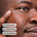 The Ordinary Salicylic Acid 2% Solution, Acne-Fighting Serum for Blemish-Prone Skin, 30ml