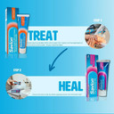 Savlon Burns & Scalds 0.25% w/w Cream, First Aid Treatment to Provide Effective Relief for Minor Burns, Scalds and Sunburn Blisters (30g, 1 pack)