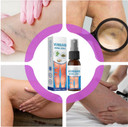 Veinguard her-bal Spray, 30ml Natural Plant Vein Soothing Spray, Veinhealing varicose Vein Treat-Ment for Legs, Improve Appearance for All Skin Types Veinguard her-bal Spray, 30ml Natural Plant Vein Soothing Spray, Veinhealing varicose Vein Treat-Ment for Legs, Improve Appearance for All Skin Types