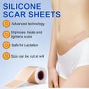 Silicone Scar Tape, Medical Grade Silicone Scar Sheets (1.6" x 120"-3M), Professional Scar Removal Treatment, Reusable Scar Tape for Healing Keloids, Surgeries Scars, C-Sections and Burns