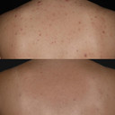 Ameliorate Transforming Clarity Body Spray 145ml | Lab6, Hyaluronic Acid, Quora Noni | Dermatologically tested