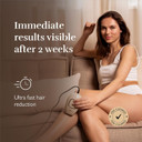 Silk'n Hair Remover for Women and Men - Infinity Fast - IPL Hair Removal Device with eHPL Technology - for Facial Hair, Bikini line and Rest of Body - Suitable or All Skin Tones - Ultra-Fast - Rose