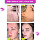 Carbon Theory VaPOREize Niacinamide Face Toner - Reduces Redness & Controls Sebum Production - Blemish Control Cleanser for Oily Skin - Exfoliating Skin Toner for Face - Vegan Facial Tonic - 250ml