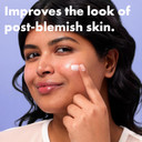 Hero Cosmetics Rescue Balm Post-Blemish Recovery Cream, Nourishing and Hydrating Moisturiser for Acne Prone Skin to Improve Skin Look, Dermatologist-Tested, Suitable for Sensitive Skin, 15 ml