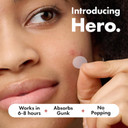 Mighty Patch Original Spot Patches by Hero Cosmetics, Day & Night Time Acne Treatment, Clear Spot Remover Hydrocolloid Patches, Anti Acne Dots, Spot Treatment Pimple Stickers - 72 Pimple Patches
