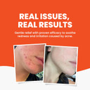 Grahams Natural Acne Face Wash - Soothing & Natural Face Wash For Acne Prone Skin - Fragrance Free Acne Spot Treatment with Aloe Vera, Cucumber & Green Tea Extract - For Sensitive Skin (125ml)