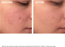 Clarins Beauty Flash Peel 50ml