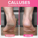 Pedicure Rasp for Dry Hard Skin - Foot File Genuine MEGAFILE Heel Care Callus Remover Dry Dead Skin Egg Corn Sander Scrubber Pumice Stone Alternative Ped Pedi Grater Files Add on Item