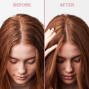 Umberto Giannini Scalp Scrub, Vegan & Cruelty Free Exfoliating Anti-Dandruff Scalp Rescue Scrub, 2 x 200ml