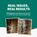 Grahams Natural Scalp Relief Oil - Scalp Treatment For Dry, Itchy & Flaky Scalp Psoriasis, Seborrheic Dermatitis & Dandruff Scalp Treatment - Hydrating, Moisturising & Exfoliating Scalp Oil (100ml)