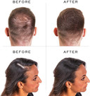 Nanogen Hair Fibres, 30 g, Medium Brown