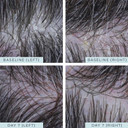 Ameliorate Transforming Scalp Serum 125ml | Lab6, Oat Oil, AHAs | Dermatologically tested, Tricologist approved