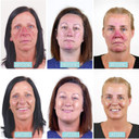 Rosalique 3 in 1 Anti-Redness Miracle Formula Colour Corrector SPF50 for Hypersensitive and Redness Prone Skin, Suitable for All Skin Types 1 x 30 ml