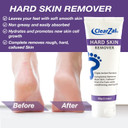 ClearZal Hard Skin Remover