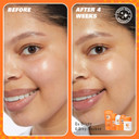 Revolution Skin, Brighten Up 3% Vitamin C Brightening Serum, Face Serum, Illuminates & Reenergises Skin, Vegan & Cruelty-Free, 30ml