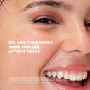 Skin Republic Glycolic Acid 10% Exfoliating Serum to visibly brighten, refine, tone and smooth skin texture (30ml)