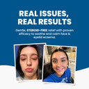 Grahams Natural Face & Eyelid Eczema Cream - Face Cream for Eczema, Dermatitis & Itch Relief - with Colloidal Oatmeal for Dry Skin, Redness & Inflammation | Hypoallergenic & Steroid-Free (100g)