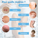 KELO-COTE Advanced Formula Scar Gel Spray, 100ml