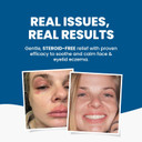 Grahams Natural Face & Eyelid Relief Pack  Clinically Proven Eczema Face Cream (50g) + Eyelid Oil (50ml)  Soothing Treatment for Dry, Itchy Skin, & Dermatitis | Steroid-Free for Sensitive Skin