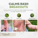 Poison Ivy Soap Bar  All Natural Poison Ivy Treatment  Anti-Itch Skin Cleanser Wash For Poison Ivy, Poison Oak & Sumac  Removes Oils, Soothes & Relieves Rashes  5Oz Jewelweed Soap Made In Usa Poison Ivy Soap Bar  All Natural Poison Ivy Treatment  Anti-Itch Skin Cleanser Wash For Poison Ivy, Poison Oak & Sumac  Removes Oils, Soothes & Relieves Rashes  5Oz Jewelweed Soap Made In Usa