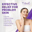 Pyrithione Zinc Soap Bar For Face & Body, 4Oz | 2% Znp Bar Soap Skin Repair Cleanser For Acne, Rosacea, Eczema, Dermatitis, Psoriasis, Itching | Cleansing, Calming Zinc Facial Wash Made In Usa