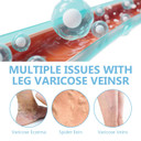 Itecfreely Varicose Veins Cream, Improve Blood Circulation Varicose Veins Care, Fast Soothe Varicose Veins Cream For Legs-80 G/ 2 Fl Oz