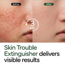 Intensive Cica Repair Cream, Korean Dexpanthenol Cream, Ultra-Soothing & Hydrating Care Cream For Sensitive Skin With Madecassoside (1.76Oz / 50G)