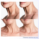 Neck Creams For Tightening And Firming: Anti - Aging Tighten And Lift Neck Cream Moisturise Wrinkle Cream For Women And Man 1.7 Oz Neck Creams For Tightening And Firming: Anti - Aging Tighten And Lift Neck Cream Moisturise Wrinkle Cream For Women And Man 1.7 Oz