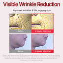 Centellian 24 Madeca Cream (Season 4, 1.7+1.7Fl Oz) - Centella Moisturizer For Face, Korean Skin Care. Dry, Sensitive Skin. Teca, Centella Asiatica, Madecassoside