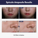 Real Spicule Ampoule With 30,000 Shots, Niacinamide, Panthenol, Liquid Skin Booster Serum, Pore Minimizer, Exfoliating, Dead Skin Cells, Skin Texture, Korean Skincare, 30Ml, 1.01 Fl. Oz