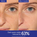 Caudalie Vinoperfect Brightening Dark Spot Serum Vitamin C Alternative - 62X More Effective Than Vitamin C With Viniferine For A Visibly Brighter Even Complexion