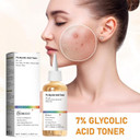 7% Glycolic Acid Exfoliating Toner, Exfoliating Facial Toner, Pore Minimizing Toner, Smooth Skin, Even Tone, Hydrating Formula