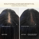 Scalp Stimulator Hair Growth Oil: Rosemary Castor Blend For Thinning Hair, Daily Nourishment & Thicker Strands, Natural Oils For Men/Women