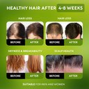 Batana Oil For Hair Growth - 100% Raw & Organic Dr Sebi Batana Oil - Cold-Pressed & Pure Unrefined Batana Hair Mask For Women & Men - Enhances Hair Thickness, Prevents Loss, Repairs Split Ends Batana Oil For Hair Growth - 100% Raw & Organic Dr Sebi Batana Oil - Cold-Pressed & Pure Unrefined Batana Hair Mask For Women & Men - Enhances Hair Thickness, Prevents Loss, Repairs Split Ends