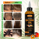Dr Sebi Raw Batana Oil, 100% Natural Organic Hair Growth Oil For Men & Women, Sourced From Honduras, Pure, Unrefined, Enhances Thickness, Prevent Hair Loss 4 Oz Dr Sebi Raw Batana Oil, 100% Natural Organic Hair Growth Oil For Men & Women, Sourced From Honduras, Pure, Unrefined, Enhances Thickness, Prevent Hair Loss 4 Oz