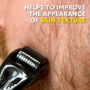 The Beard Club Premium Derma Roller For Face, Body And Scalp - Microneedling Roller For Men And Women With 540 Titanium Microneedles - For Hair & Beard - Weighted Metal Handle - Magnetic Storage Case