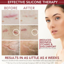 Physician Formulated Silicone Scar Gel Semi-Solid Sheeting - Advanced Crosspolymer Medical Grade Liquid Sheeting For Face, Body, Surgery, C Section, Burn, Keloidal & Hypertrophic Scars