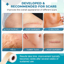 Silicone Scar Sheets, Silicone Scar Tape(1.6X 120 Roll-3M), Silicone Scar Strips, Professional Scar Removal Sheets For Surgical Scars, Keloid, C-Section, Burn Et