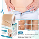 Silicone Scar Sheets, Silicone Scar Tape(1.6X 120 Roll-3M), Silicone Scar Strips, Professional Scar Removal Sheets For Surgical Scars, Keloid, C-Section, Burn Et