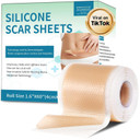 Silicone Scar Sheets, Silicone Scar Tape(1.6X 60 Roll-1.5M), Silicone Scar Strips, Professional Scar Removal Sheets For Surgical Scars, Keloid, C-Section, Burn Et