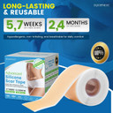 Silicone Scar Sheets,Silicone Scar Tape, (1.6 X 60 Roll, 1.5M) Scar Removal Strips For Surgical Scars,Keloids, C-Section, & Burns Tummy Tuck Reusable Tape