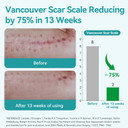 Dimora Waterproof Silicone Scar Sheets - Medical Grade Hypoallergenic Silicone Scar Tape (1.6X60" Roll), Ultra-Soft Scar Removal Treatment For Surgical Scars, C Section, Tummy Tuck, Keloid Treatment