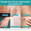 Dimora Waterproof Silicone Scar Sheets - Medical Grade Hypoallergenic Silicone Scar Tape (1.6X60" Roll), Ultra-Soft Scar Removal Treatment For Surgical Scars, C Section, Tummy Tuck, Keloid Treatment