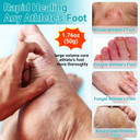 Athletes Foot Treatment Cream, Maximum Strength For Athlete'S Foot (Tinea Pedis), Itching, Blister, Burning, Cracking, Scaling, Beriberi,Natural Herbs Antifungal Foot Cream